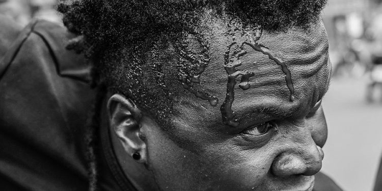 Uganda Law Society Condemns Violent Crackdown on NUP Campaign in Gulu