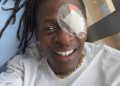 Ugandan Star Jose Chameleon Speaks Out After Successful Eye Procedure