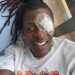 Ugandan Star Jose Chameleon Speaks Out After Successful Eye Procedure